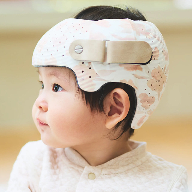 あたまのかたち外来の治療期間の目安