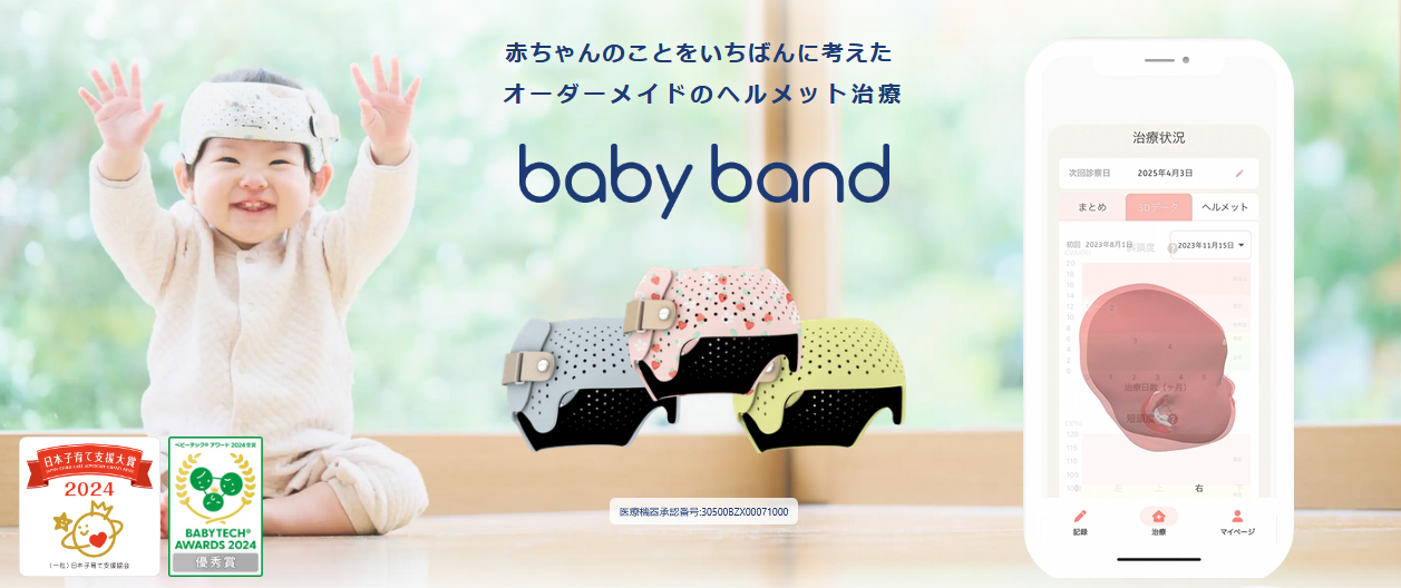 ベビーバンド|ヘルメット治療で赤ちゃんの頭のゆがみを矯正